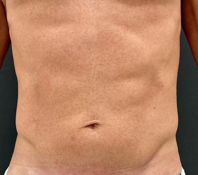 After image